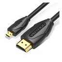 VENTION KÁBEL MICRO HDMI TO HDMI 150CM FULL HD