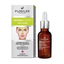 Floslek Dermo Expert Anti Acne 30ml kyslý peeling P1