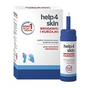 Help4Skin na bradavice a bradavice aerosól 50 ml