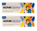 ACNE-DERM acnederm Kyselina azelaová 20% AKNÉ 20g