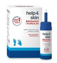 Help4skin bradavice a bradavice 50 ml