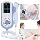 JUMPER JPD-100E Baby Fetálny Detektor srdcového tepu MEDICAL 2,5 MHz hlavica