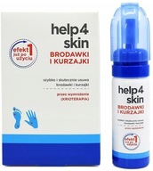 Help4Skin Warts and Warts prípravok na odstránenie bradavíc a bradavíc 50 ml