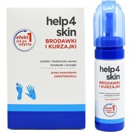 Help4skin bradavice a bradavice 50 ml