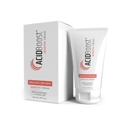 ACIDBOOST Sensitive krém 50 ml