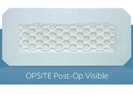 Smith Nephew OPSITE POST-OP VIDIBLE 20 x 10cm 1ks