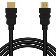 5X HDMI KÁBEL 4K UHD FULL HD 1,5M SET