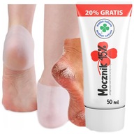 Dobrý krém na suché päty s UREA 45% exfoliačný + silikónové OBALY